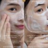 LA’DERM Oxygen Cleansing Foam Usage (1) LA’DERM Oxygen Cleansing Foam